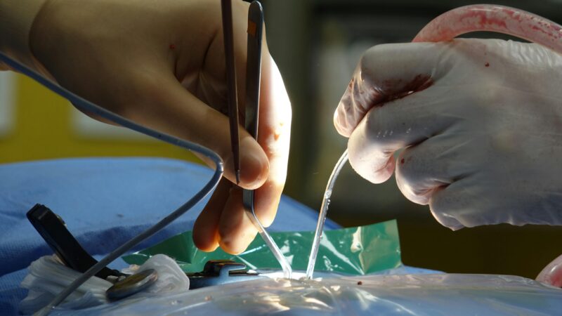 Close-Up of Surgical Procedure in Operating Room
