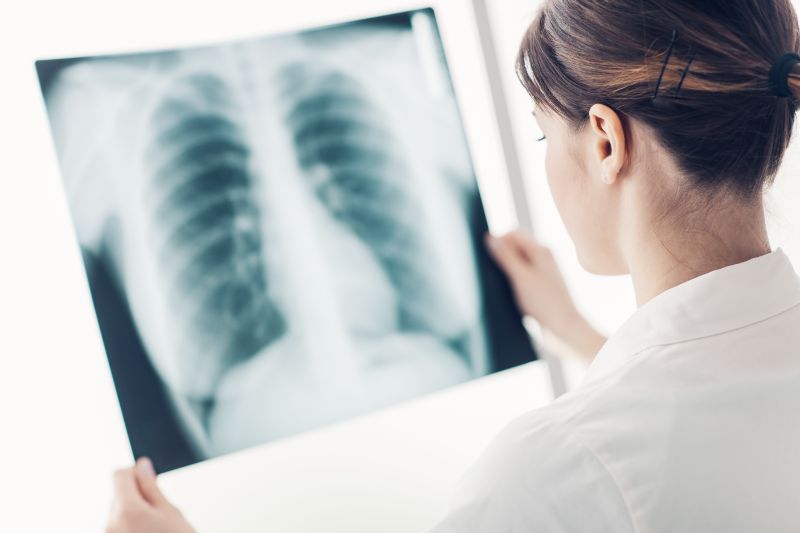 Woman radiologist reviewing x-ray result